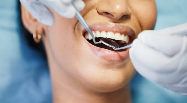 Best Emergency Dentist for Knocked-Out Tooth in Detroit, MI